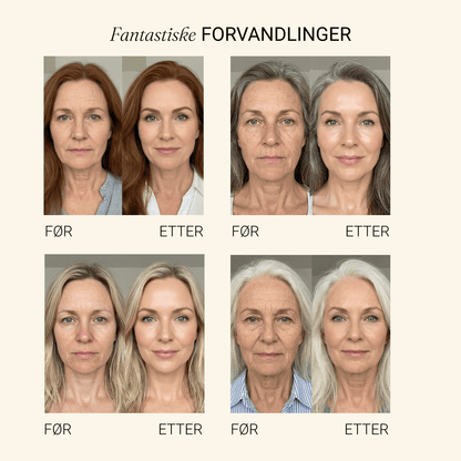 Changing Foundation
